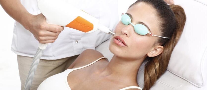 Lasersko obnavljanje kože